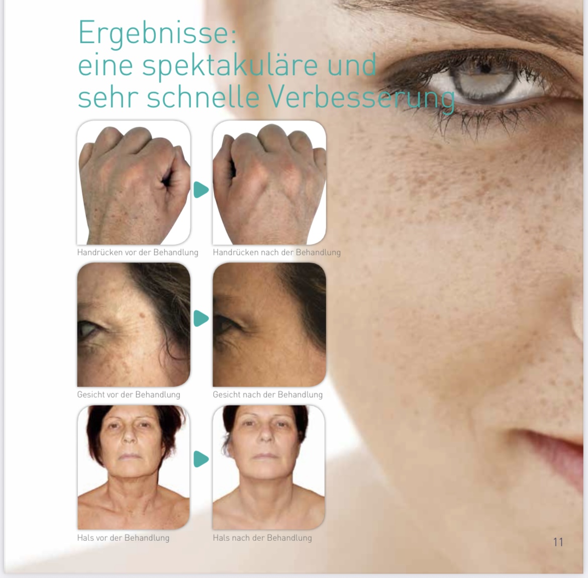 Schnelle Ergebnisse Ergebnisse