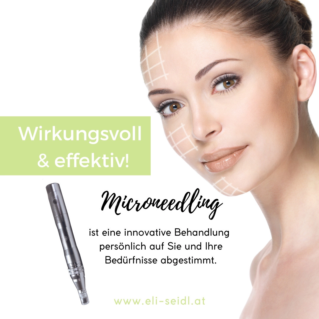 microneedling